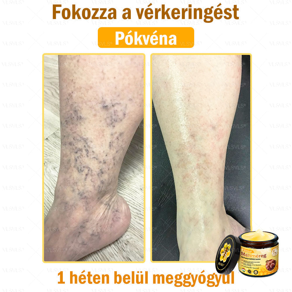 VLSVLS® Méhméreg Bőrhelyreállító Krém✅ – Utolsó nap! 80% kedvezmény 🔥