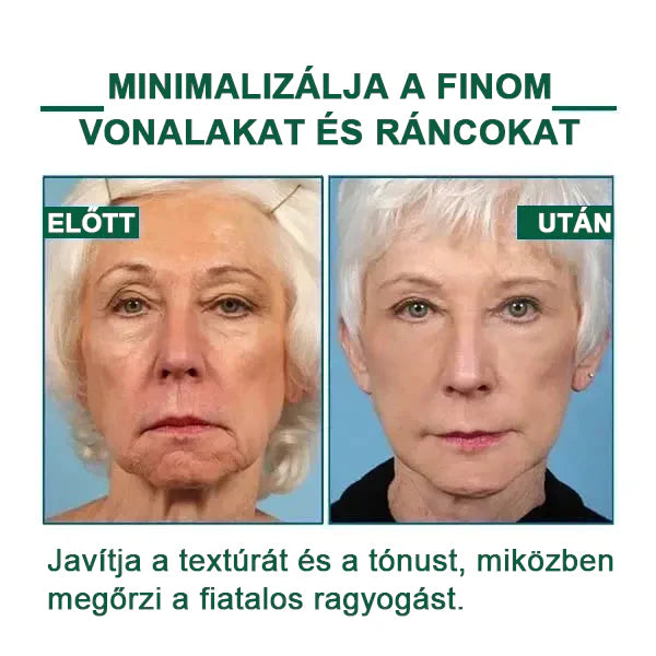 【✨utánvétel (COD)✨】Akció utolsó napja 80% kedvezmény - Fubsta™ Fiatalító és feszesítő bőrszérum🔥