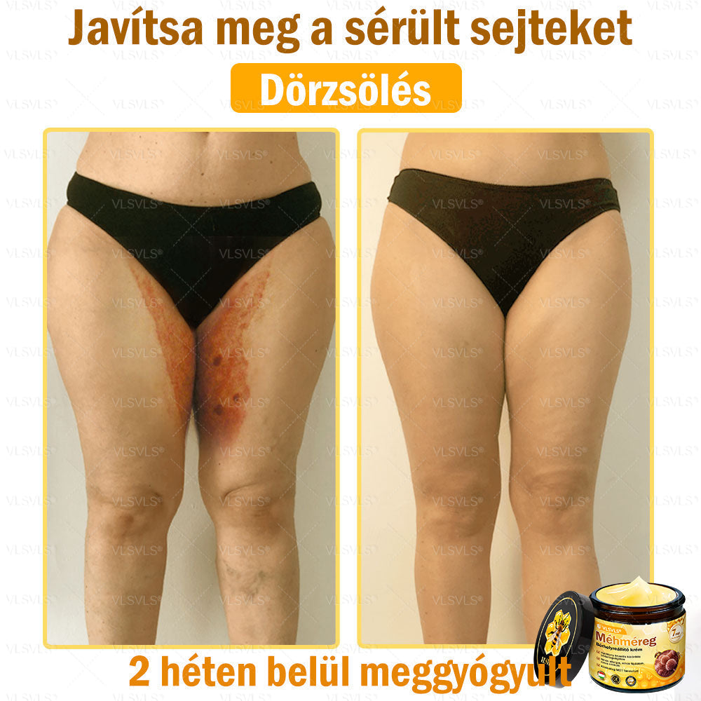 VLSVLS® Méhméreg Bőrhelyreállító Krém✅ – Utolsó nap! 80% kedvezmény 🔥