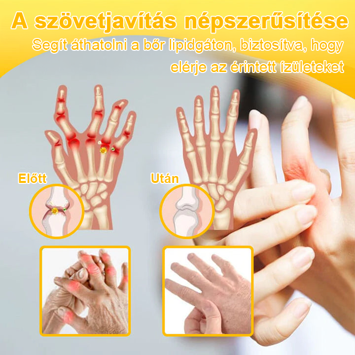✅TLOPA® Fájdalomcsillapító, csontregeneráló krém botulinum-toxinnal és méhméreggel 🐝