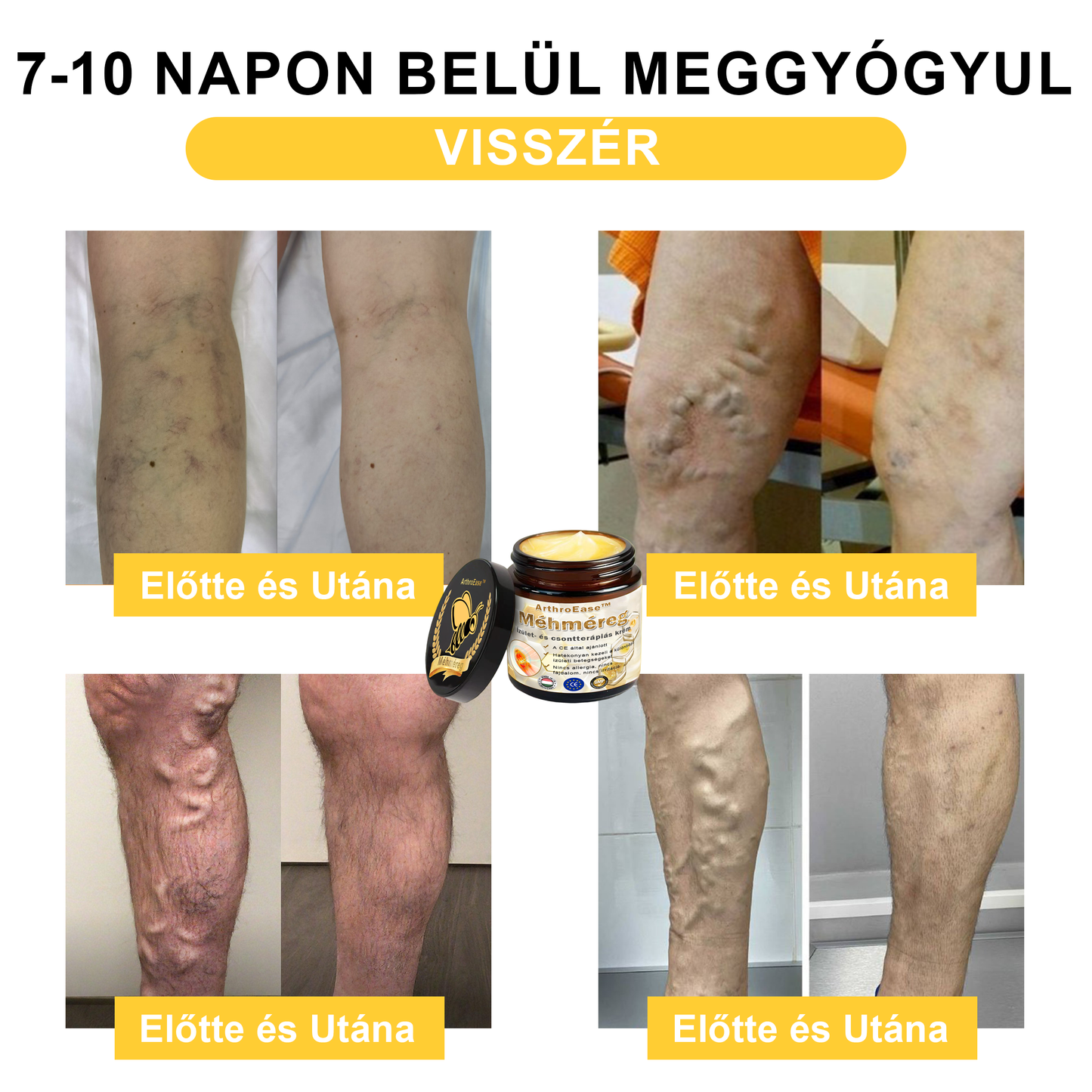 ArthroEase™ Méhméreg ízületi terápiás krém (kifejezetten idősebb felnőttek számára és az AAOS ajánlja)🐝🎁
