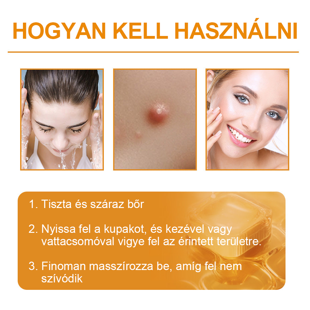 🌱🍯🐝BENETURE™ méhméreg szemölcs és anyajegy eltávolító krém (Utolsó napi akció, 80% kedvezmény)