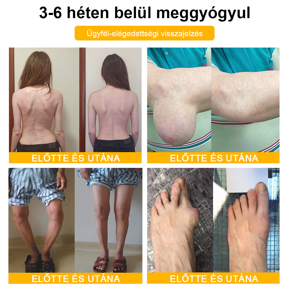 ✅TLOPA® Fájdalomcsillapító, csontregeneráló krém botulinum-toxinnal és méhméreggel 🐝