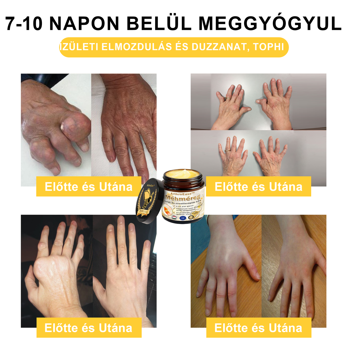 ArthroEase™ Méhméreg ízületi terápiás krém (kifejezetten idősebb felnőttek számára és az AAOS ajánlja)🐝🎁