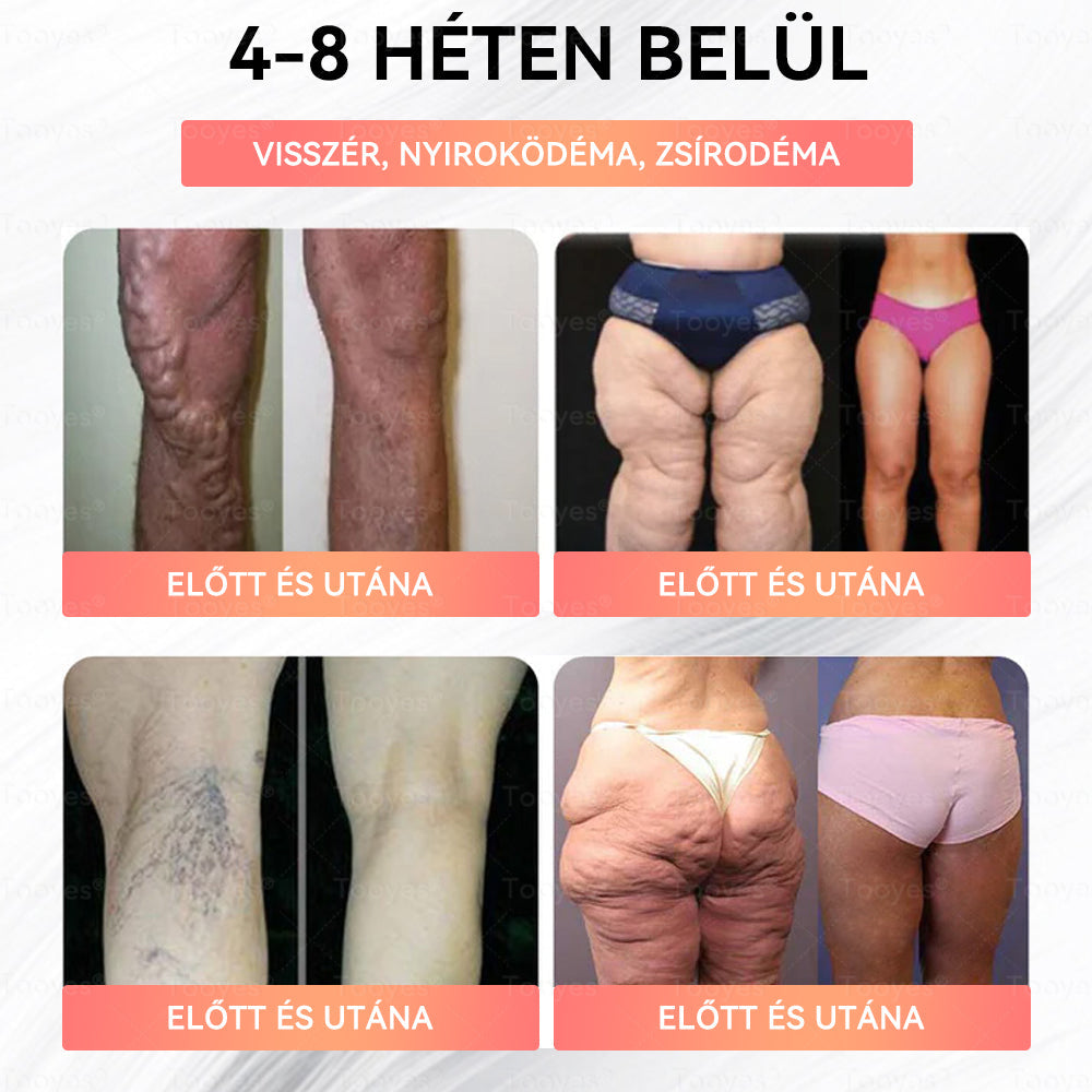 đ„đ„TooyesÂź GLP-1 Magas KoncentrĂĄciĂłjĂș FolyĂ©kony Gyöngyök â NAD+, Moringa, HCA összetevĆkkel (FogyĂĄs, ĂregedĂ©sgĂĄtlĂĄs, BĂ©l- Ă©s Immunrendszer tĂĄmogatĂĄs, VĂ©rcukorszint egyensĂșly, SzĂv- Ă©s AgyegĂ©szsĂ©g) âĄ