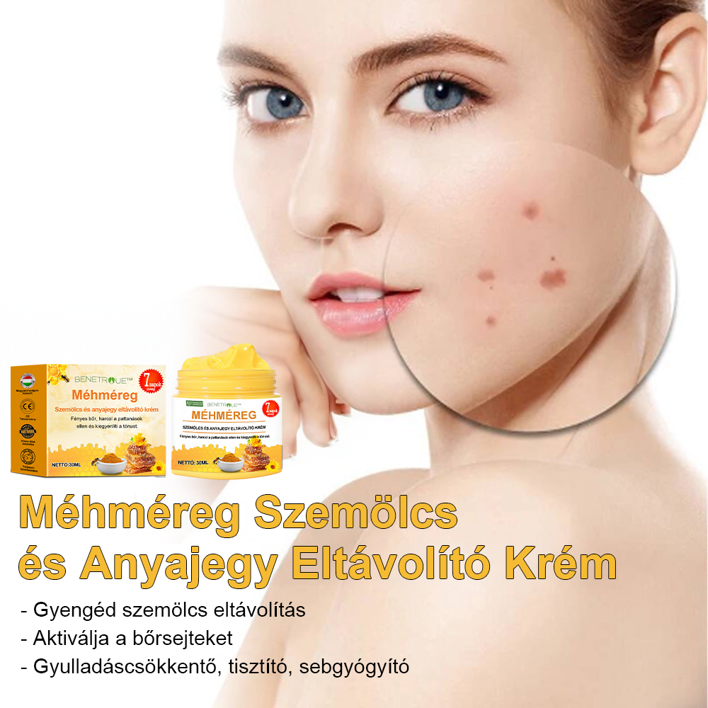 🌱🍯🐝BENETURE™ méhméreg szemölcs és anyajegy eltávolító krém (Utolsó napi akció, 80% kedvezmény)