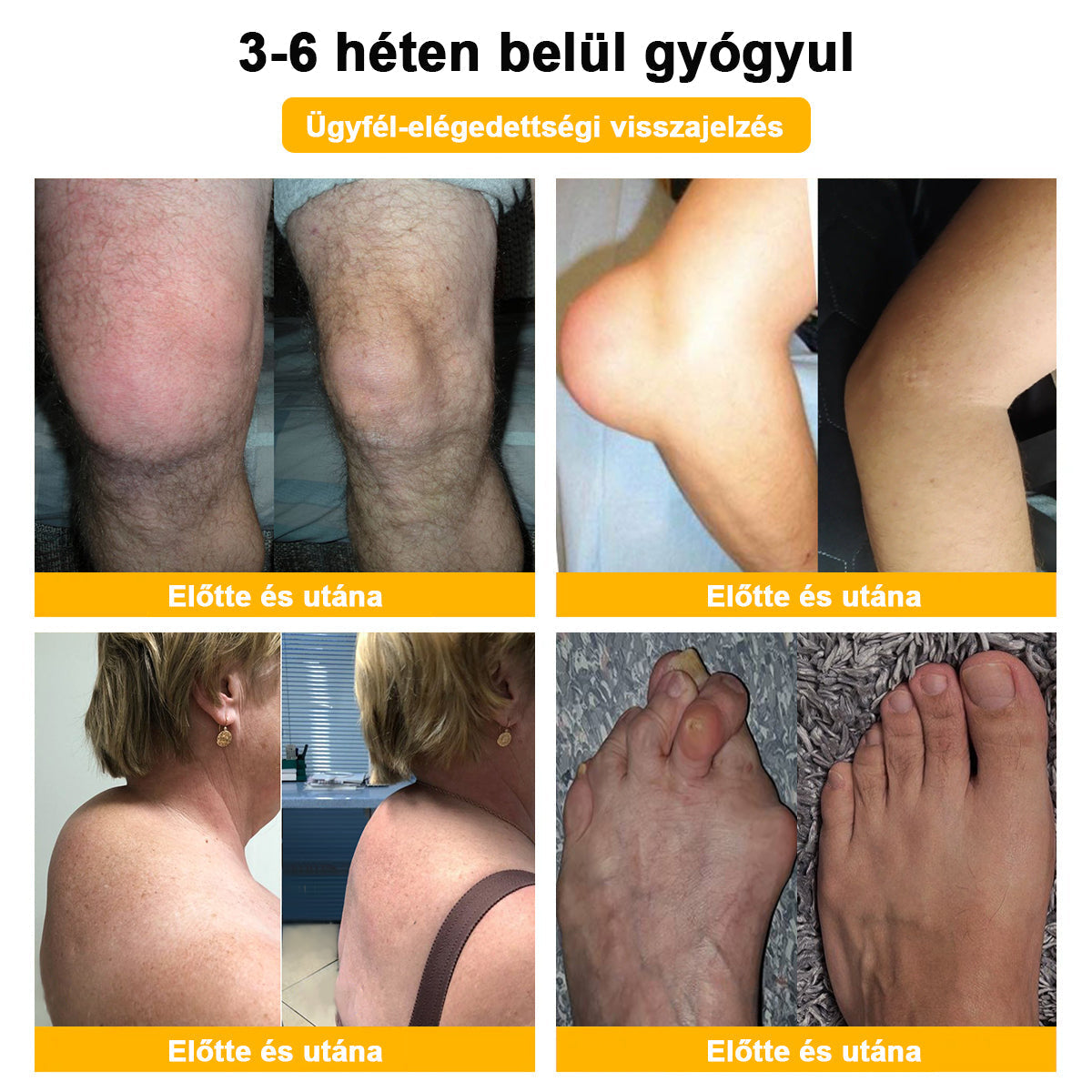 BSWELL® Méregtelenítő és csontregeneráló krém🌱𝐀𝐀𝐎𝐒 𝐚𝐣á𝐧𝐥𝐣𝐚 (Szakosodott ortopédiai betegségekre és fájdalomra)🌈
