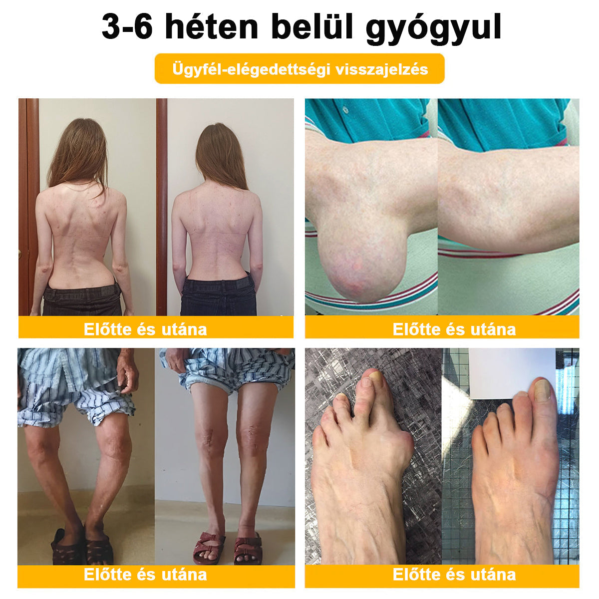 BSWELL® Méregtelenítő és csontregeneráló krém🌱𝐀𝐀𝐎𝐒 𝐚𝐣á𝐧𝐥𝐣𝐚 (Szakosodott ortopédiai betegségekre és fájdalomra)🌈