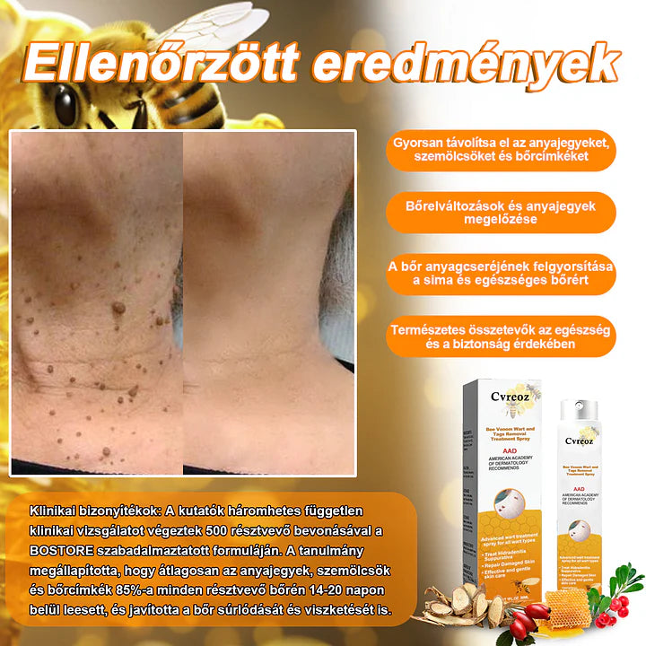 đCvreoz spray szemölcsök Ă©s anyajegyek eltĂĄvolĂtĂĄsĂĄra mĂ©hmĂ©reggel (đšââDDG AJĂNLĂS)đđ(đ„utolsĂł napi ajĂĄnlat 80% kedvezmĂ©nnyel)