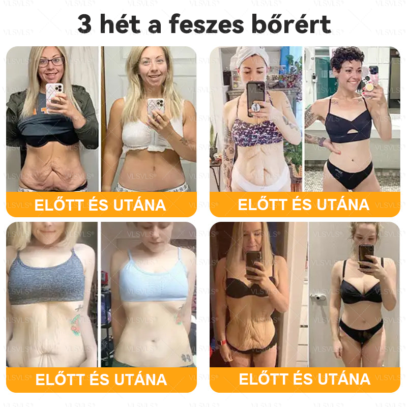 🌿 VLSVLS® Méhméreg Bőrhelyreállító Krém ✨ UTOLSÓ NAP – 80% KEDVEZMÉNY 🏆