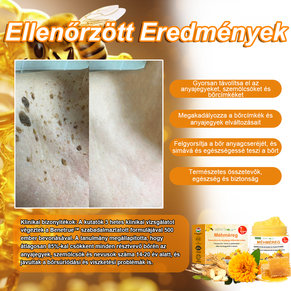 🌱🍯🐝BENETURE™ méhméreg szemölcs és anyajegy eltávolító krém (Utolsó napi akció, 80% kedvezmény)