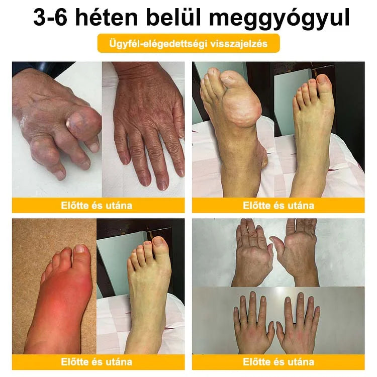 🌿🌿 BEARNICA™ Bee Venom Advanced ízület- és csontkezelő krém🔥 (Utolsó napi akció, 70% kedvezmény)