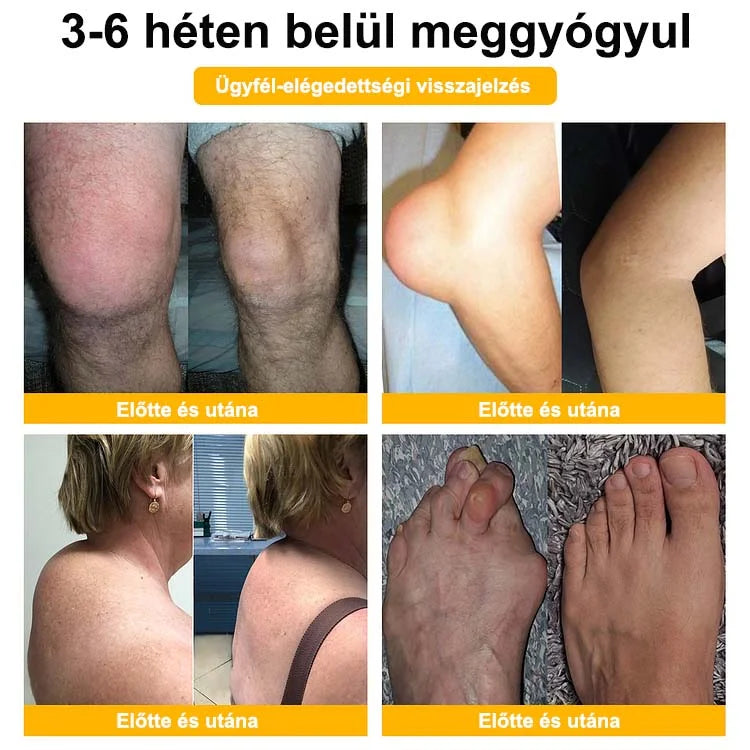 🌿🌿 BEARNICA™ Bee Venom Advanced ízület- és csontkezelő krém🔥 (Utolsó napi akció, 70% kedvezmény)