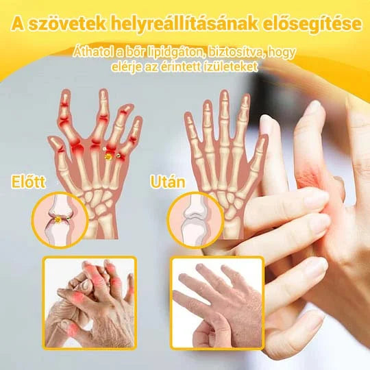 🌿🌿 BEARNICA™ Bee Venom Advanced ízület- és csontkezelő krém🔥 (Utolsó napi akció, 70% kedvezmény)