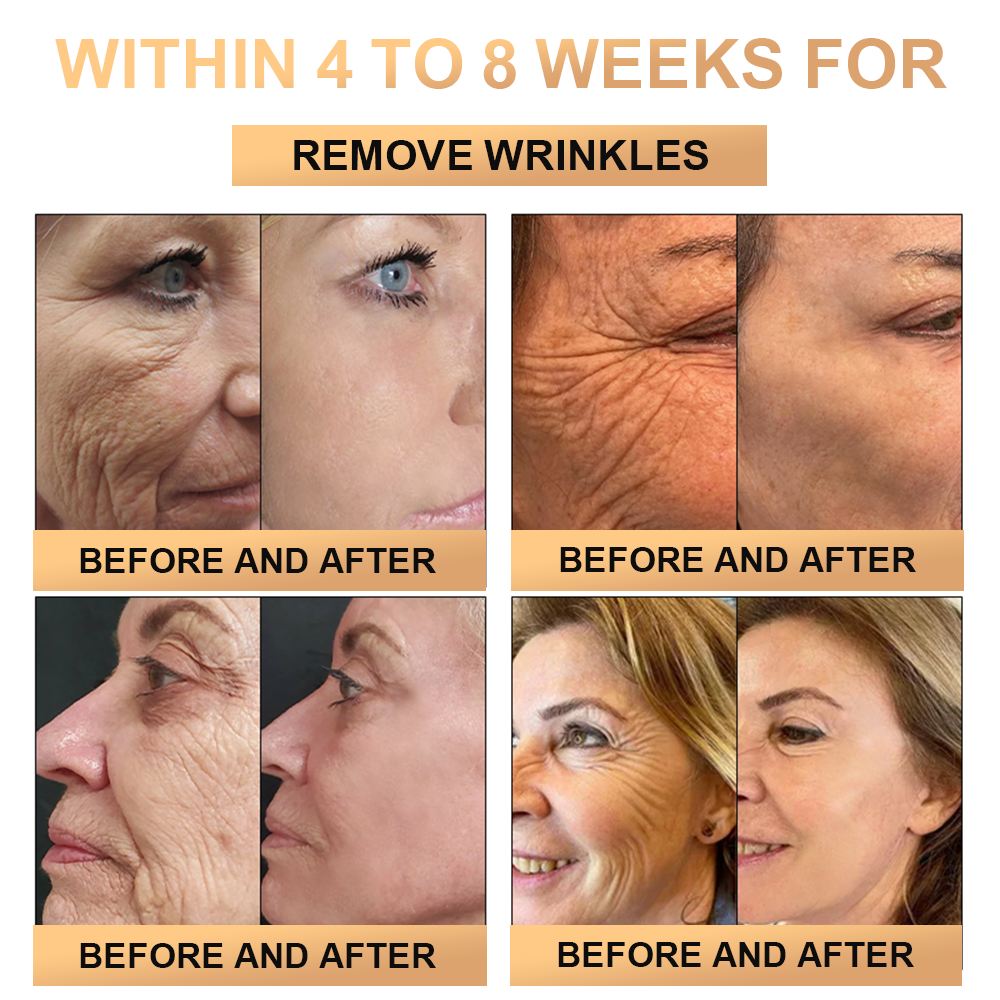 đ„đ„đ„PLTOWEâą Super Anti-Aging Creamđ„ KorlĂĄtozott idejƱ kedvezmĂ©ny UtolsĂł 30 perc (Minden korosztĂĄly szĂĄmĂĄra alkalmas)