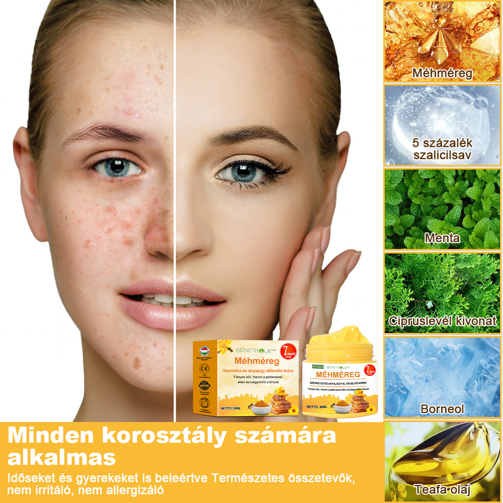 🌱🍯🐝BENETURE™ méhméreg szemölcs és anyajegy eltávolító krém (Utolsó napi akció, 80% kedvezmény)