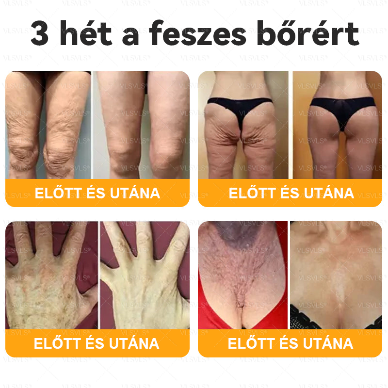 🌿 VLSVLS® Méhméreg Bőrhelyreállító Krém ✨ UTOLSÓ NAP – 80% KEDVEZMÉNY 🏆