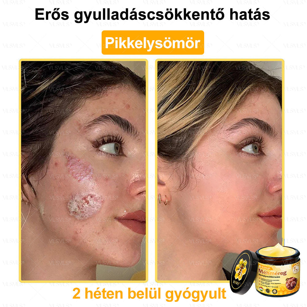 VLSVLS® Méhméreg Bőrhelyreállító Krém✅ – Utolsó nap! 80% kedvezmény 🔥