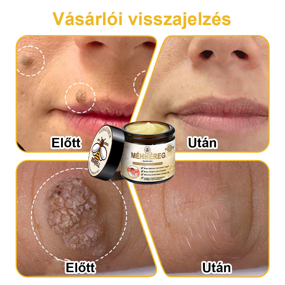 đđ BSWELLÂź MĂ©hmĂ©reg KrĂ©m đšââïž( AAD AjĂĄnlĂĄsĂĄval )đ„ UtolsĂł nap: 80% KedvezmĂ©ny