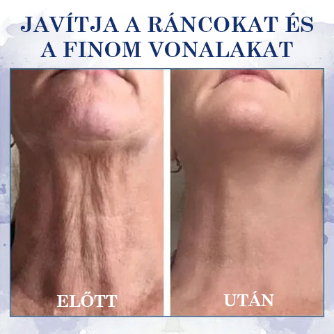 🔥👩⚕️ Utolsó nap kedvezmény: 75% KEDVEZMÉNY 🔥 Fubsta® Haladó Feszesítő és Ránccsökkentő Krém: Visszaállítja a bőr rugalmasságát