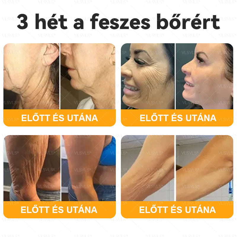 🌿 VLSVLS® Méhméreg Bőrhelyreállító Krém ✨ UTOLSÓ NAP – 80% KEDVEZMÉNY 🏆