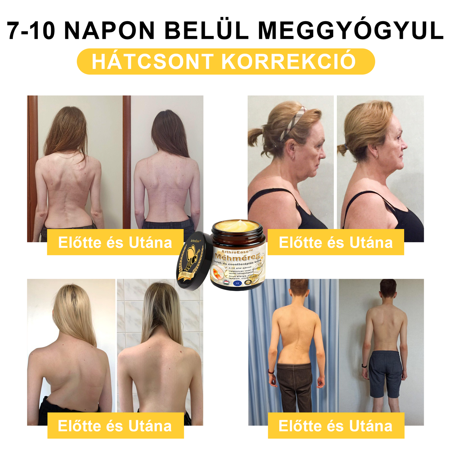 ArthroEase™ Méhméreg ízületi terápiás krém (kifejezetten idősebb felnőttek számára és az AAOS ajánlja)🐝🎁