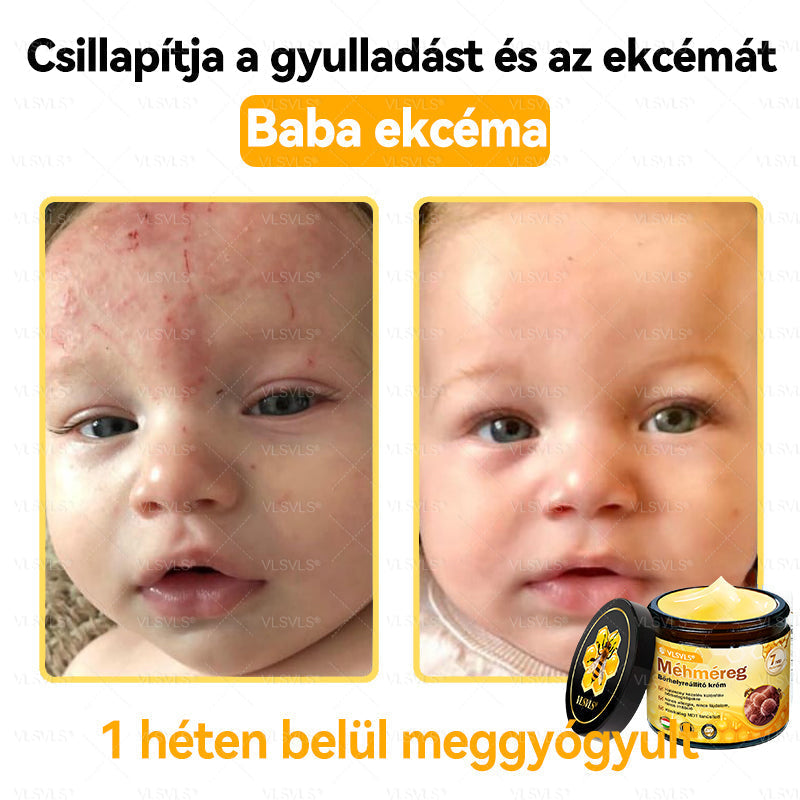 VLSVLS® Méhméreg Bőrhelyreállító Krém✅ – Utolsó nap! 80% kedvezmény 🔥