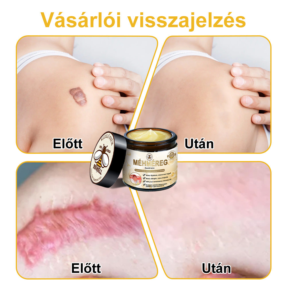 đđ BSWELLÂź MĂ©hmĂ©reg KrĂ©m đšââïž( AAD AjĂĄnlĂĄsĂĄval )đ„ UtolsĂł nap: 80% KedvezmĂ©ny
