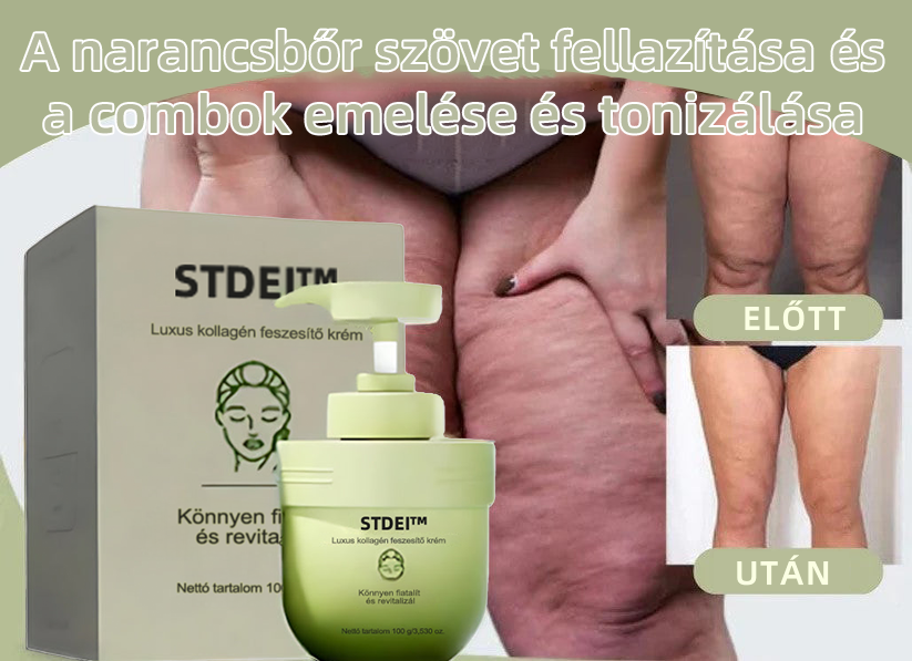 STDEI™ Luxus Kollagénfeszesítő Krém (🔥70% kedvezmény korlátozott ideig!)💥