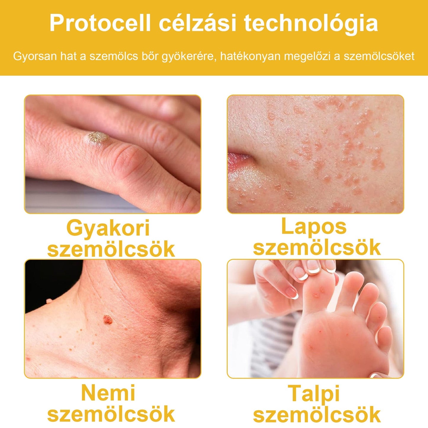 đđ BSWELLÂź MĂ©hmĂ©reg KrĂ©m đšââïž( AAD AjĂĄnlĂĄsĂĄval )đ„ UtolsĂł nap: 80% KedvezmĂ©ny