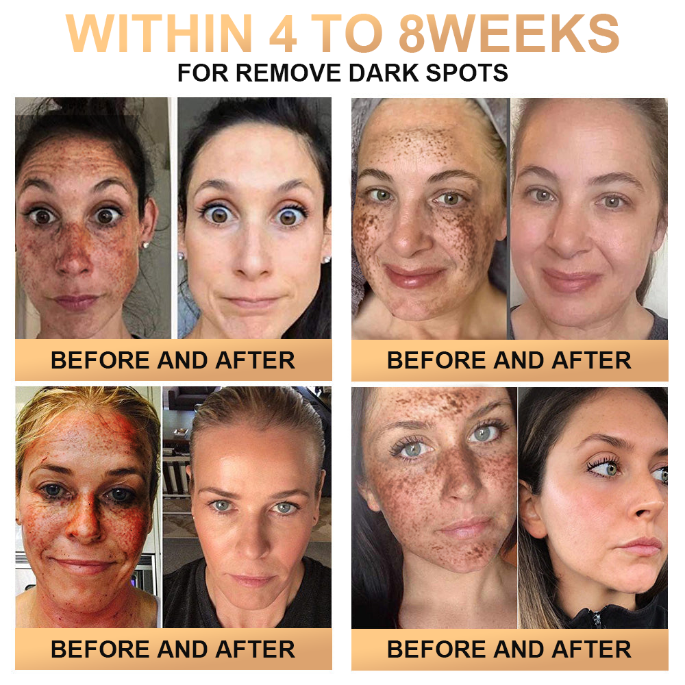 đ„đ„đ„PLTOWEâą Super Anti-Aging Creamđ„ KorlĂĄtozott idejƱ kedvezmĂ©ny UtolsĂł 30 perc (Minden korosztĂĄly szĂĄmĂĄra alkalmas)