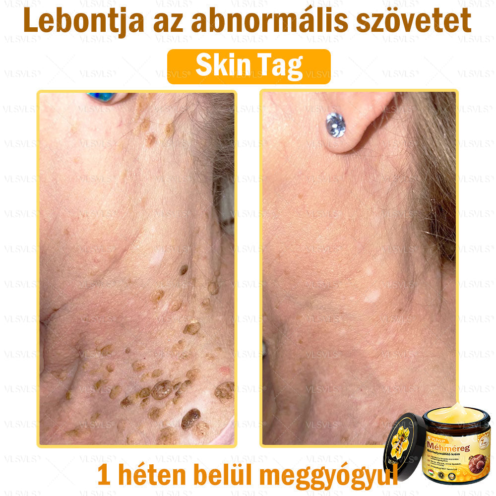 VLSVLS® Méhméreg Bőrhelyreállító Krém✅ – Utolsó nap! 80% kedvezmény 🔥