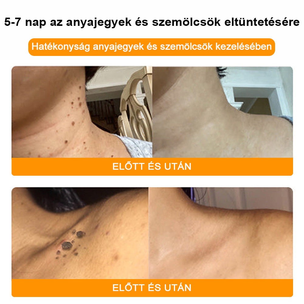 đđ BSWELLÂź MĂ©hmĂ©reg KrĂ©m đšââïž( AAD AjĂĄnlĂĄsĂĄval )đ„ UtolsĂł nap: 80% KedvezmĂ©ny