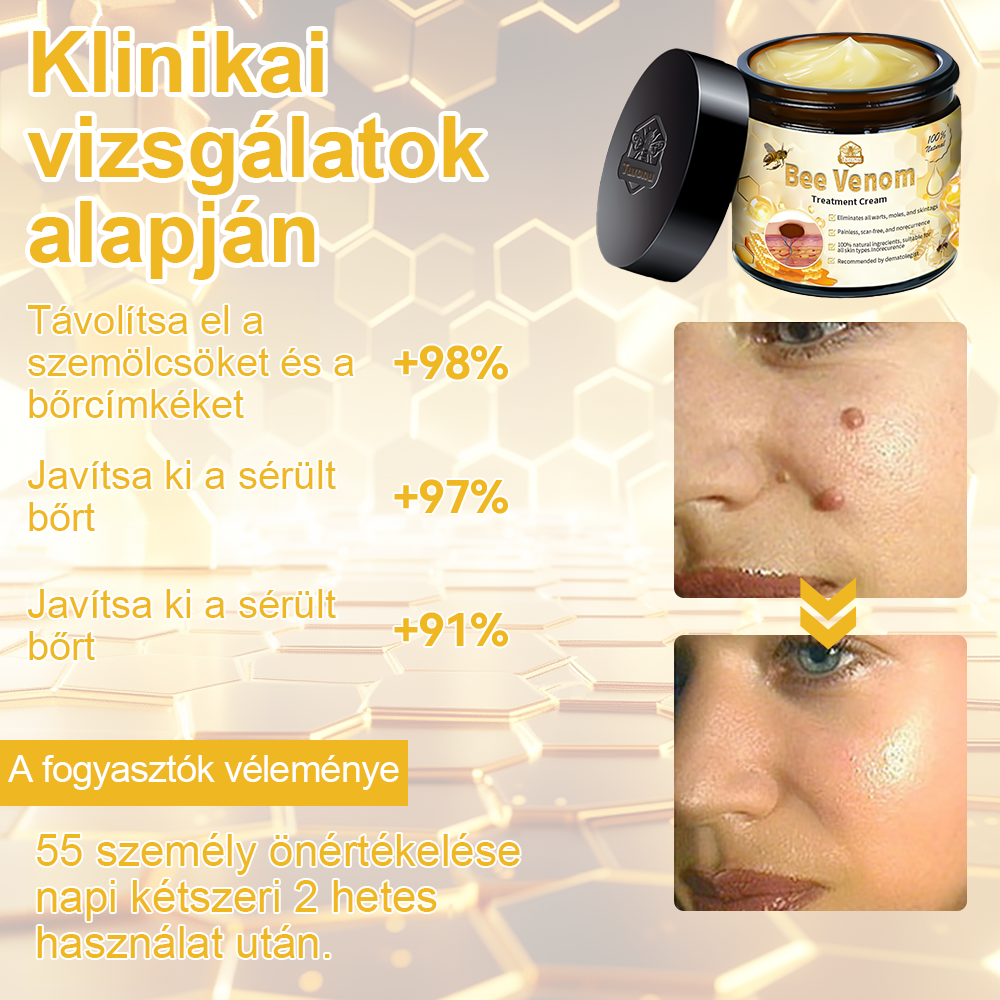 đ”ïžTuronuâą mĂ©hmĂ©reg kezelĆ bĆrkrĂ©m (az MDT ajĂĄnlĂĄsĂĄval)đUtĂĄnvĂ©t Ă©s az utolsĂł nap a korlĂĄtozott idejƱ kedvezmĂ©nyre