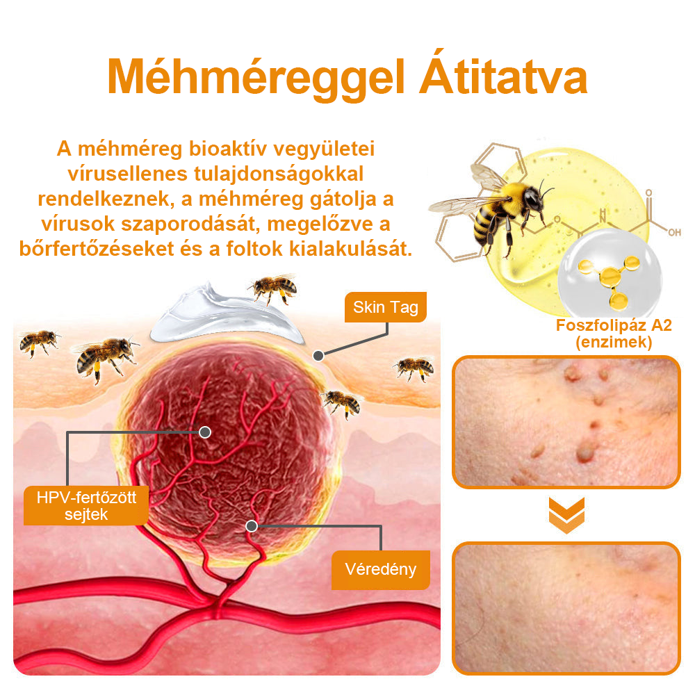 🌱🍯🐝BENETURE™ méhméreg szemölcs és anyajegy eltávolító krém (Utolsó napi akció, 80% kedvezmény)