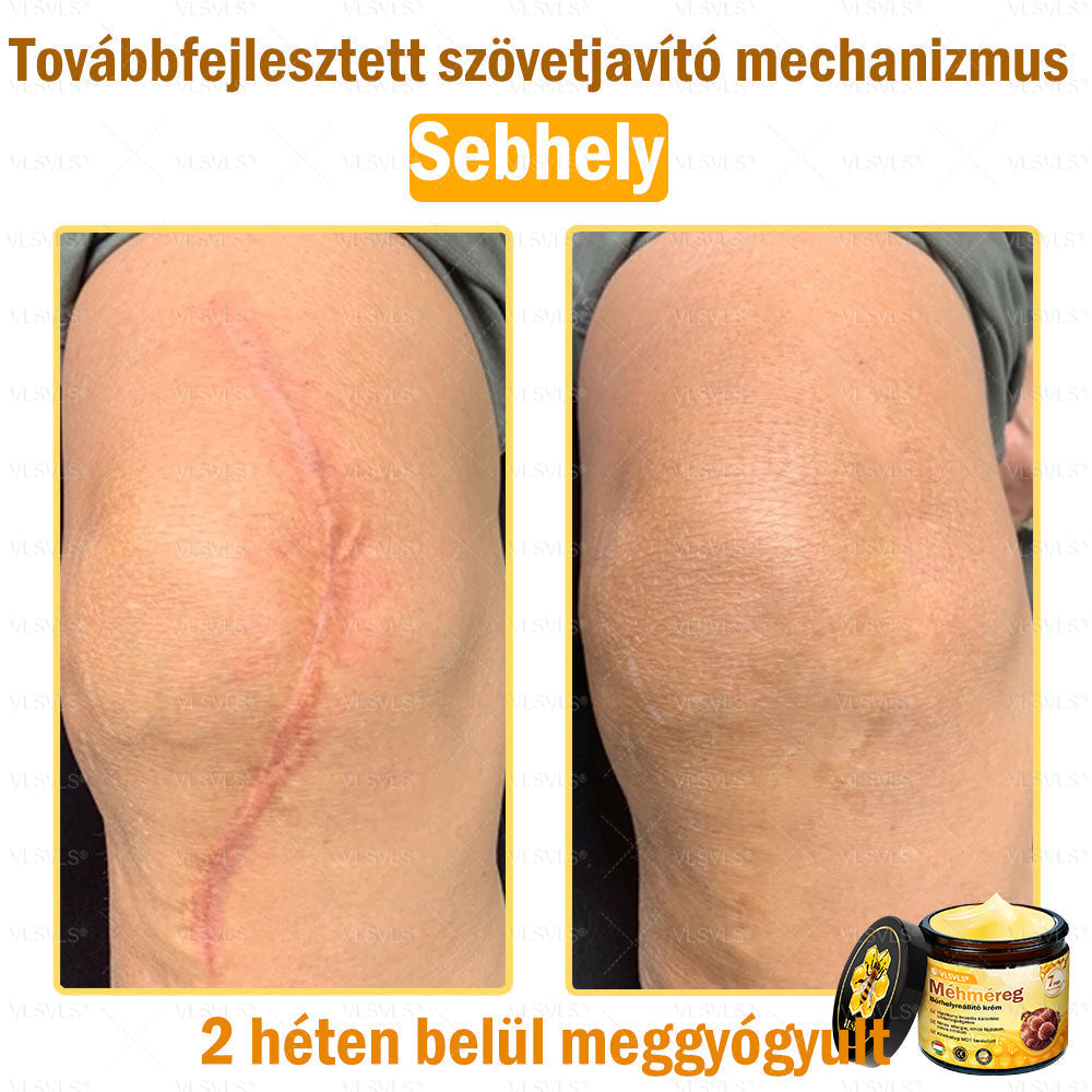 VLSVLS® Méhméreg Bőrhelyreállító Krém✅ – Utolsó nap! 80% kedvezmény 🔥