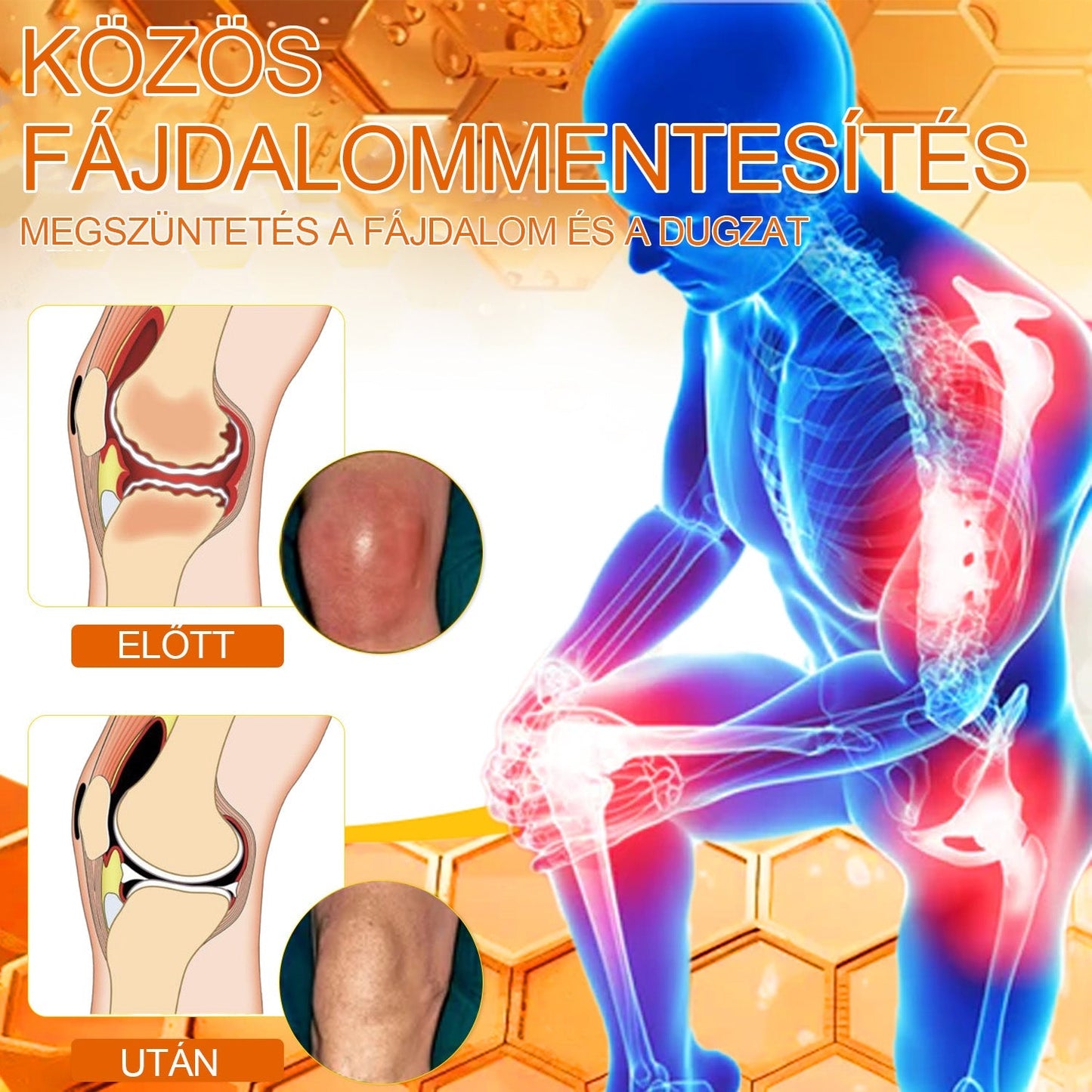 ArthroEase™ Méhméreg ízületi terápiás krém (kifejezetten idősebb felnőttek számára és az AAOS ajánlja)🐝🎁