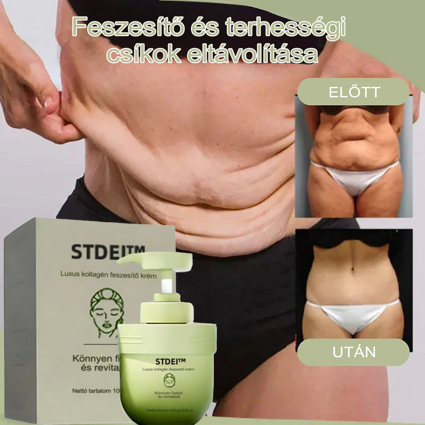 STDEI™ Luxus Kollagénfeszesítő Krém (🔥70% kedvezmény korlátozott ideig!)💥