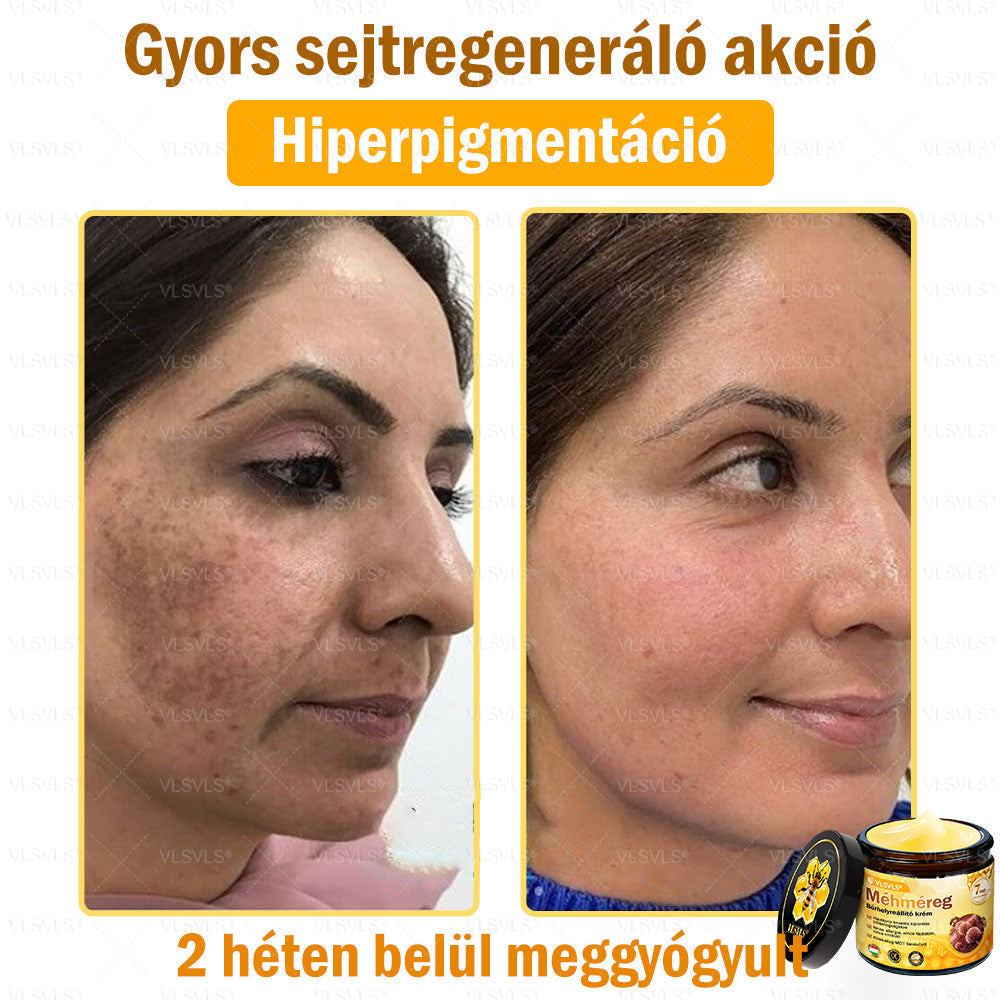 VLSVLS® Méhméreg Bőrhelyreállító Krém✅ – Utolsó nap! 80% kedvezmény 🔥
