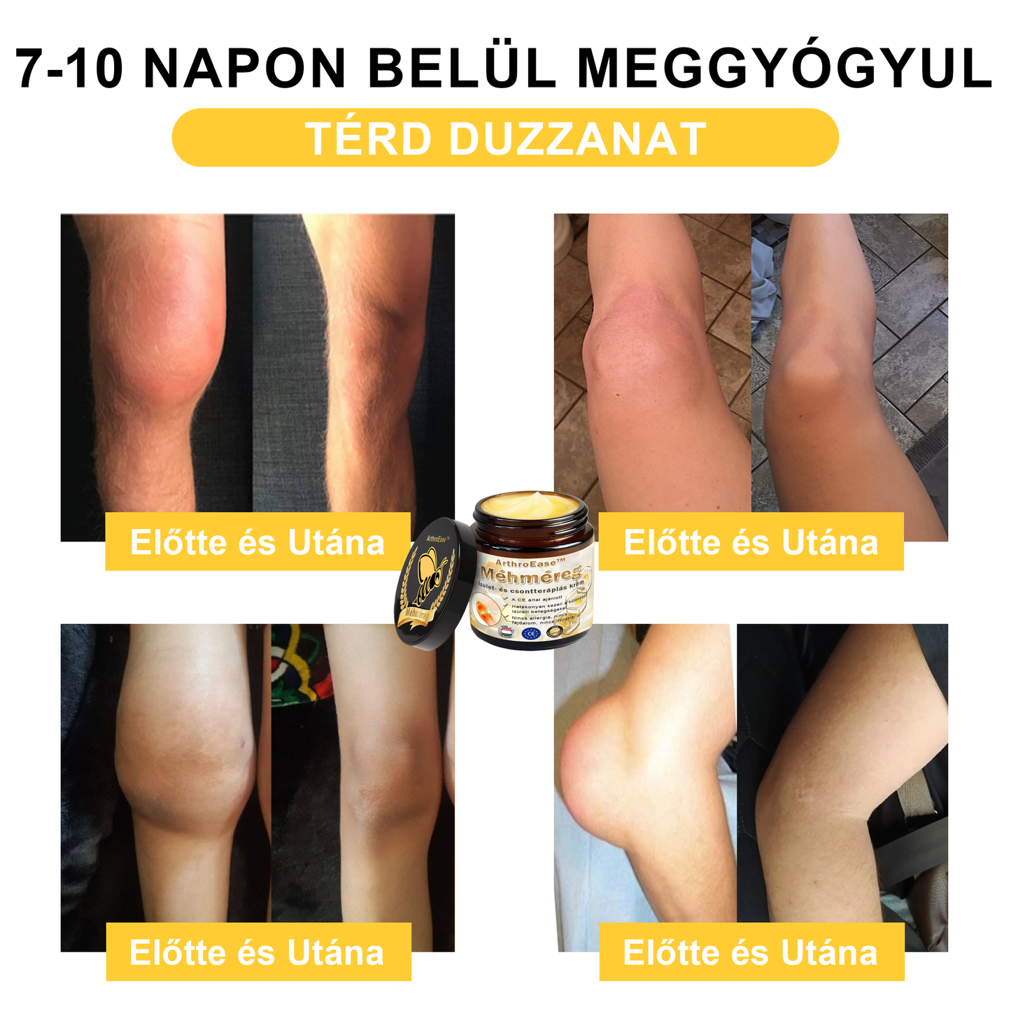 ArthroEase™ Méhméreg ízületi terápiás krém (kifejezetten idősebb felnőttek számára és az AAOS ajánlja)🐝🎁