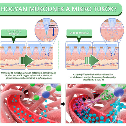 [Lásd az eredményeket 7 nap múlva]🌲0yikey™ SMGT-GLP-1 nano mikrotűs tapasz (Fájdalommentes, hosszan tartó, kezeli a cukorbetegséget, az elhízást és a szív- és érrendszeri betegségeket)🔥🔥