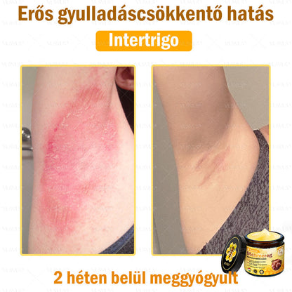 VLSVLS® Méhméreg Bőrhelyreállító Krém✅ – Utolsó nap! 80% kedvezmény 🔥