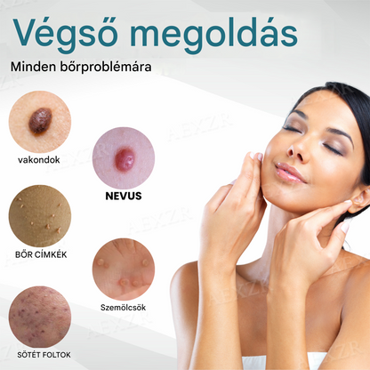 Bikenda® non-invazív anyajegy- és szemölcseltávolító lézertoll🌟