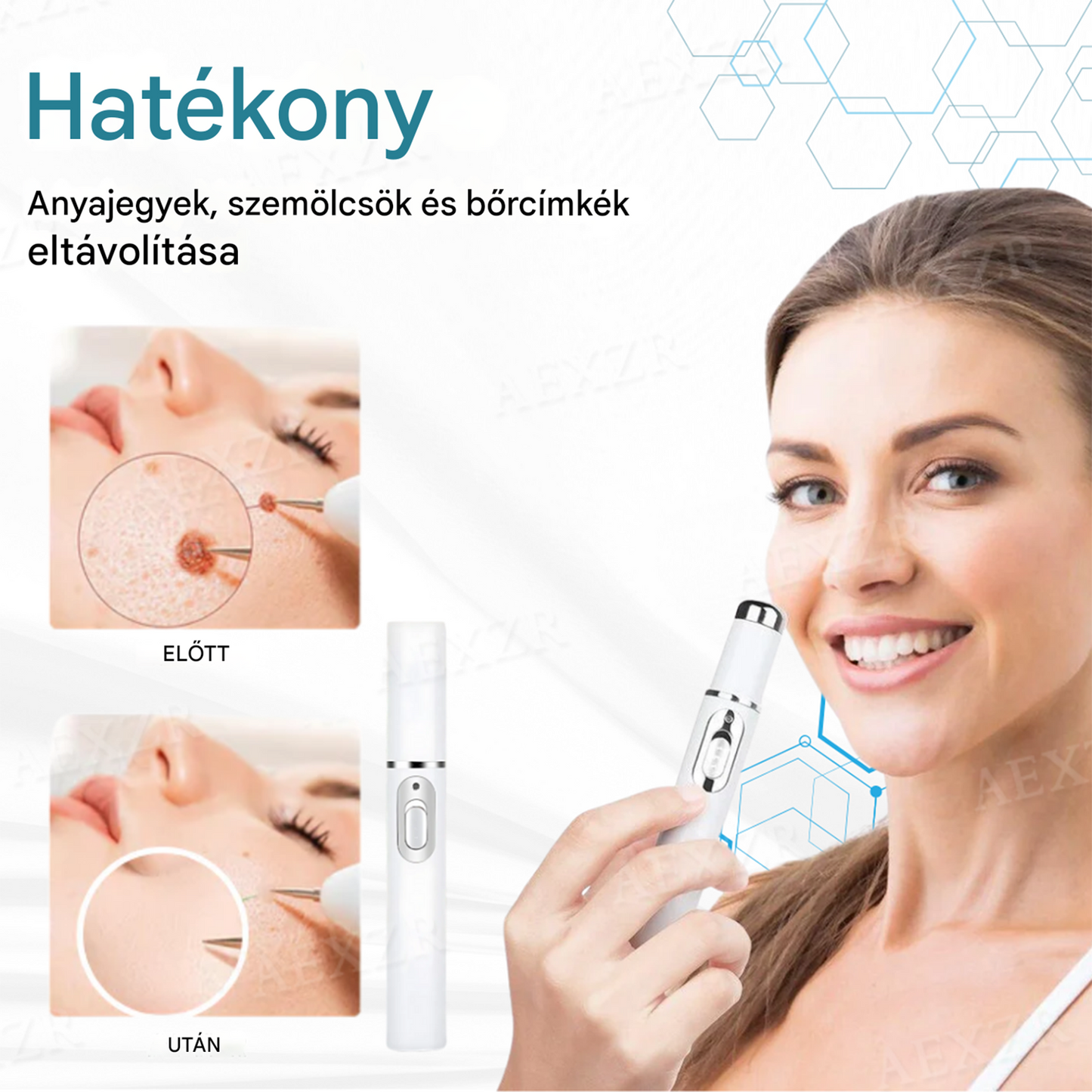 Bikenda® non-invazív anyajegy- és szemölcseltávolító lézertoll🌟