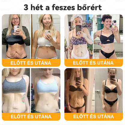 🌿 VLSVLS® Méhméreg Bőrhelyreállító Krém ✨ UTOLSÓ NAP – 80% KEDVEZMÉNY 🏆