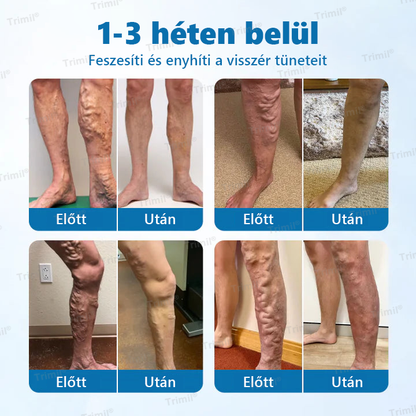 🌿Trimil® VeinGuard Gyógynövényes Spray - 👨‍⚕️ Klinikailag bizonyított, hogy mindössze 7 nap alatt megszünteti a visszereket!✨