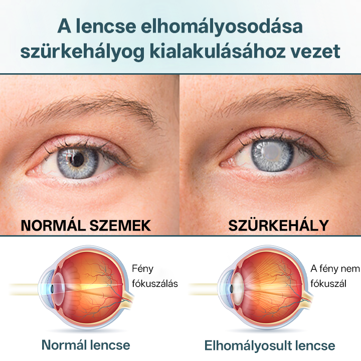 ✅Timilk® OptiFusion Nano szemcsepp szérum🌟