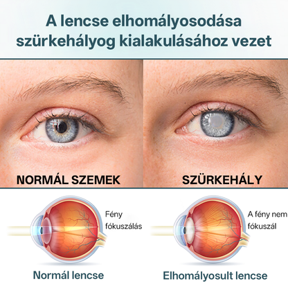 ✅Timilk® OptiFusion Nano szemcsepp szérum🌟