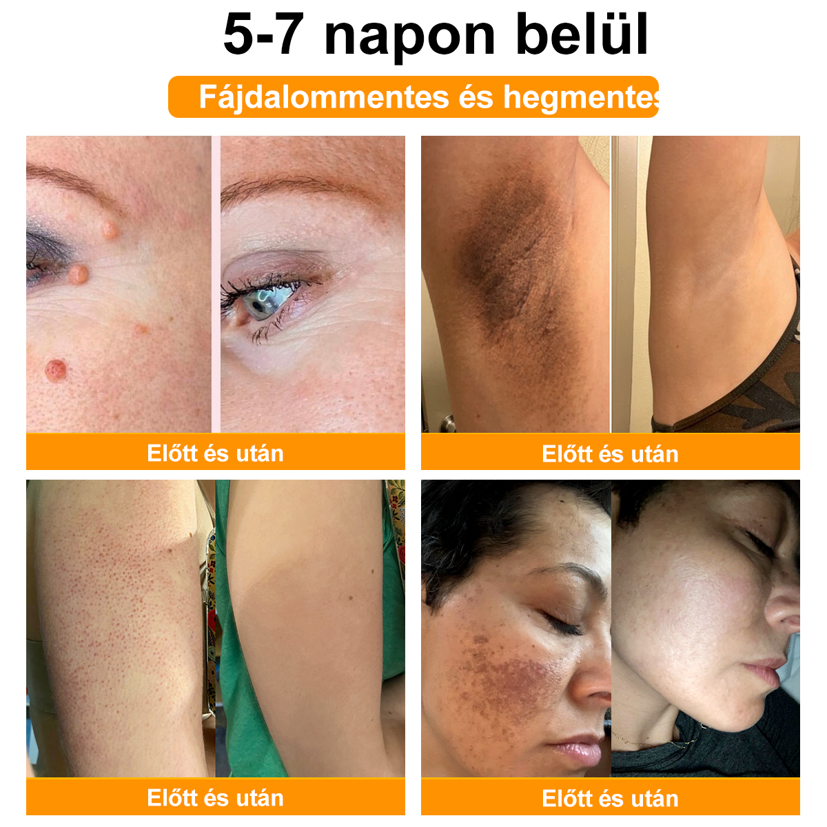 🐝💖 BSWELL® Méhméreg Krém 👨‍⚕️( AAD Ajánlásával )🔥 Utolsó nap: 80% Kedvezmény