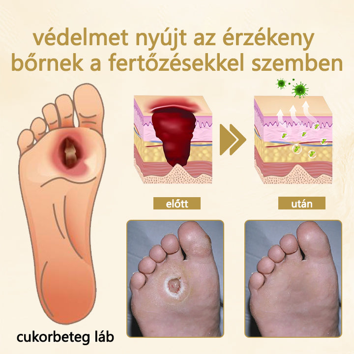 Cvreoz® méhméreg gyógyító spray a sebek gyógyulására és regenerálására a kezeken és a lábakon🌿🌿